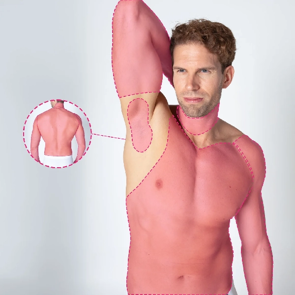 Depilação a laser para a parte superior do corpo com tecnologia de díodo