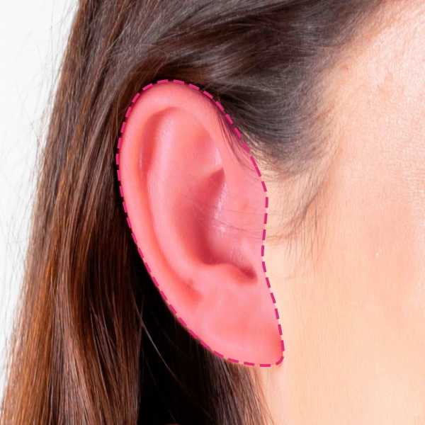 Depilação a laser nas orelhas femininas para remoção de vello na zona auricular