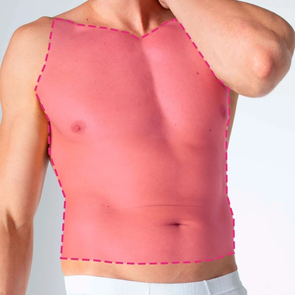 Depilação a laser no tórax completo masculino com tecnología de diodo