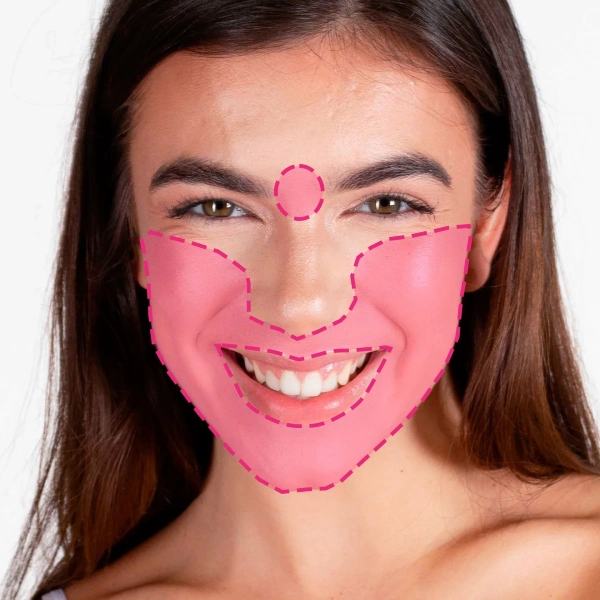 Depilação a laser de díodo em facial completo feminino com tecnologia avançada e resultados duradouros
